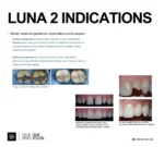 LUNA 2 - Image 3