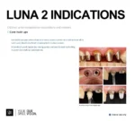 LUNA 2 - Image 4