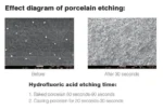 Porcelain Etch (Hydrofluoric Acid Etchant) - Dentex - Image 2